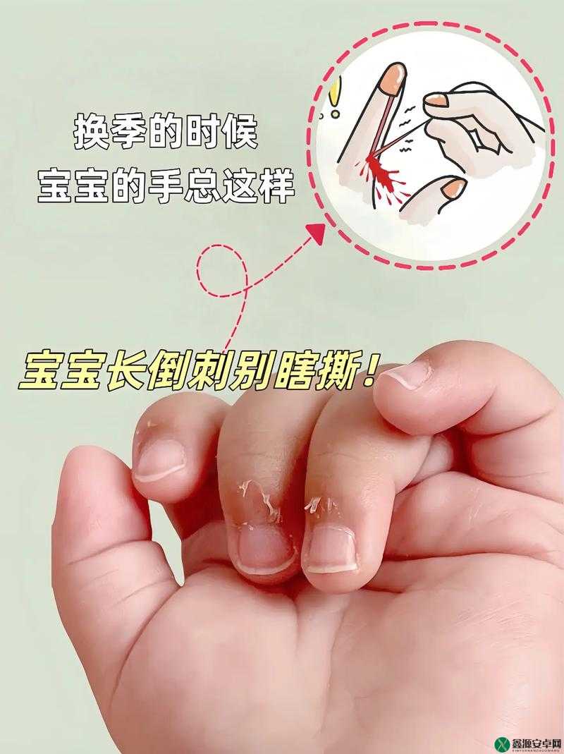 宝宝手指痛的原因：为何才三根就疼